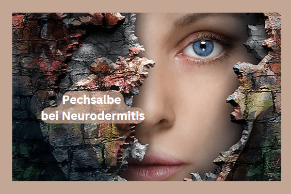 Hast du schon von der erstaunlichen Wirkung der Pechsalbe bei Neurodermitis oder Schuppenflechte gehört? In diesem Blogartikel erfährst du alles, was du über diese natürliche Heilmethode wissen musst. Von der Definition von Neurodermitis und Schuppenflechte über die genaue Wirkungsweise der Pechsalbe bei Neurodermitis oder Schuppenflechte bis hin zu Erfahrungsberichten von Betroffenen und wissenschaftlichen Studien - hier findest du alles, was du wissen musst, um deine Hautprobleme effektiv zu behandeln.